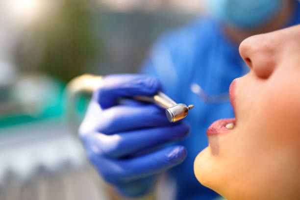 Dental Inlays and Onlays in Parrish, AL